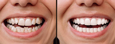 Rehabilitación bucal